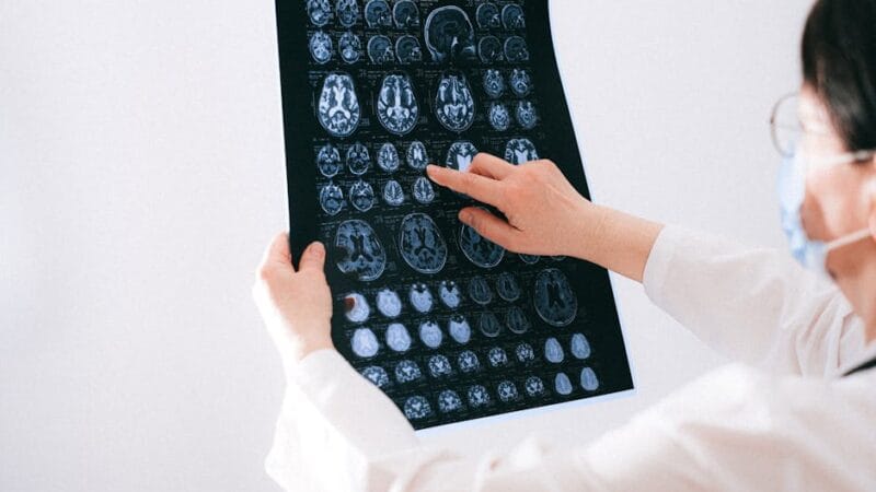 Résoudre les Problèmes d’Accès à Japscan Efficacement